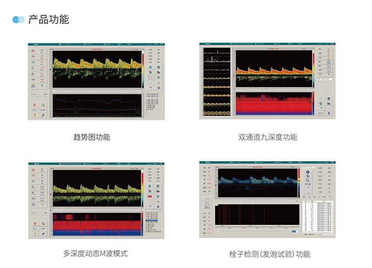 便攜經顱多普勒儀