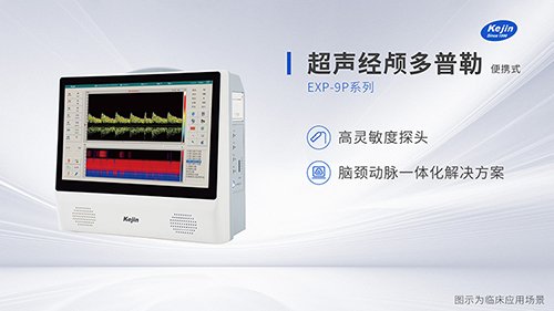 經(jīng)顱多普勒是如何檢測(cè)血管的